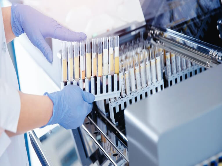 Lineare Bewegungssysteme in automatisierten RT-PCR-Tests medizinischer Anwendungen